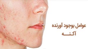 عوامل ایجاد یا تشدید آکنه | کلینیک زیبایی ژالان اصفهان